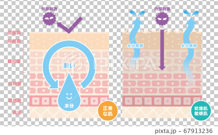 正常な肌と乾燥肌、敏感肌を比較した肌の断面図、イラスト 67913236