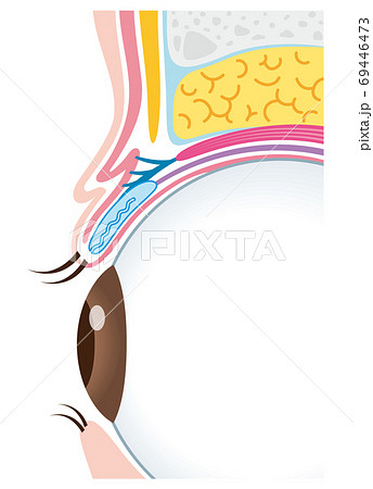 二重瞼の構造　まぶた　断面図 69446473