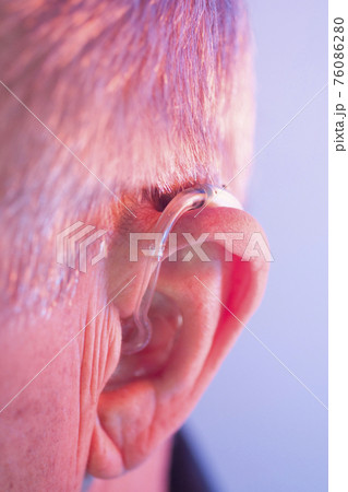 Man with hearing aid 76086280