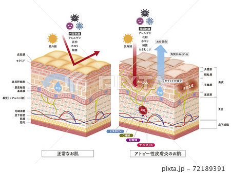 Cross section of the skin 3 72189391