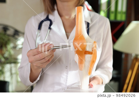 Woman doctor holds anatomical model of human knee-joint and points by pen. 98492026