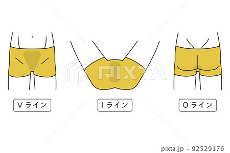 メンズ脱毛、Vライン・Iライン・Oラインのセット、下着着用 92529176