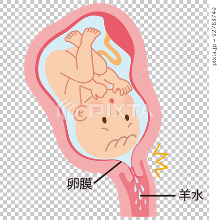 前期破水　子宮の中の赤ちゃん　妊娠中の母体の仕組み 92783749