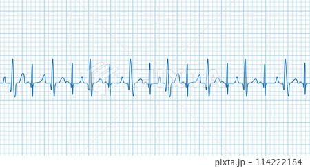 方眼紙の心電図 114222184
