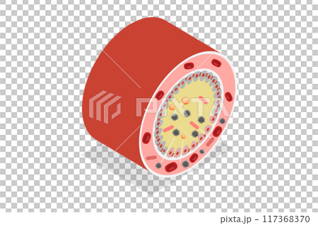 3D Isometric Flat  Illustration of Celiac Disease, Gluten Intolerance 117368370