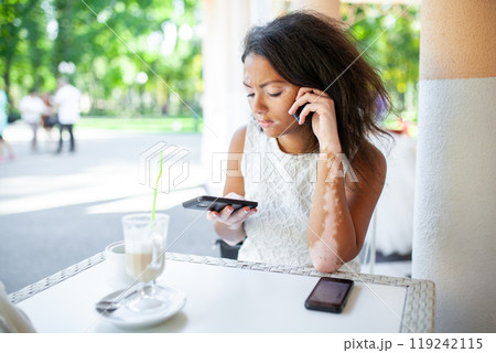 Woman with vitiligo using smartphone while sitting 119242115