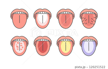 舌の健康状態　種類　イラストセット 120251522