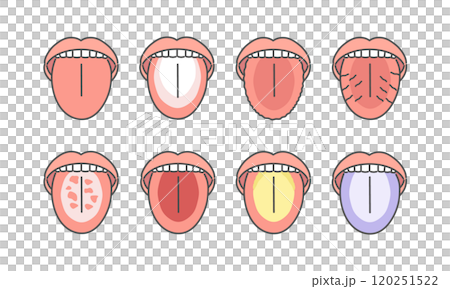 舌の健康状態　種類　イラストセット 120251522