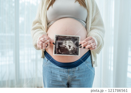 Young pregnant woman holding ultrasound scan photo of a fetus in front of her belly in third trimester at home. Concept of pregnancy, sonography. Maternity prenatal care 121786561