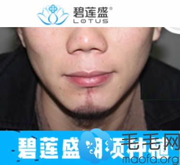 在碧莲盛种山羊胡1个月后终于有了男人味