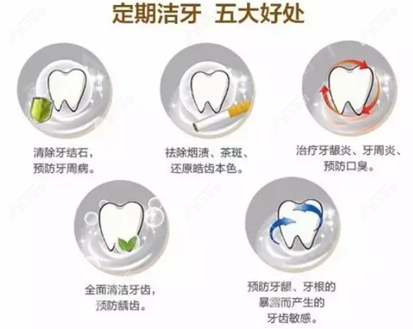 2022年上海疫情期间哪里可以洗牙，洗牙价格会不会变贵