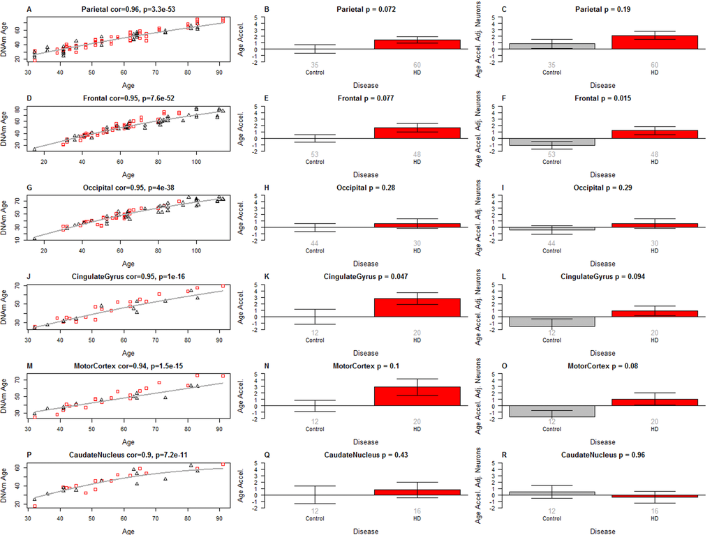 Epigenetic age acceleration in specific brain regions