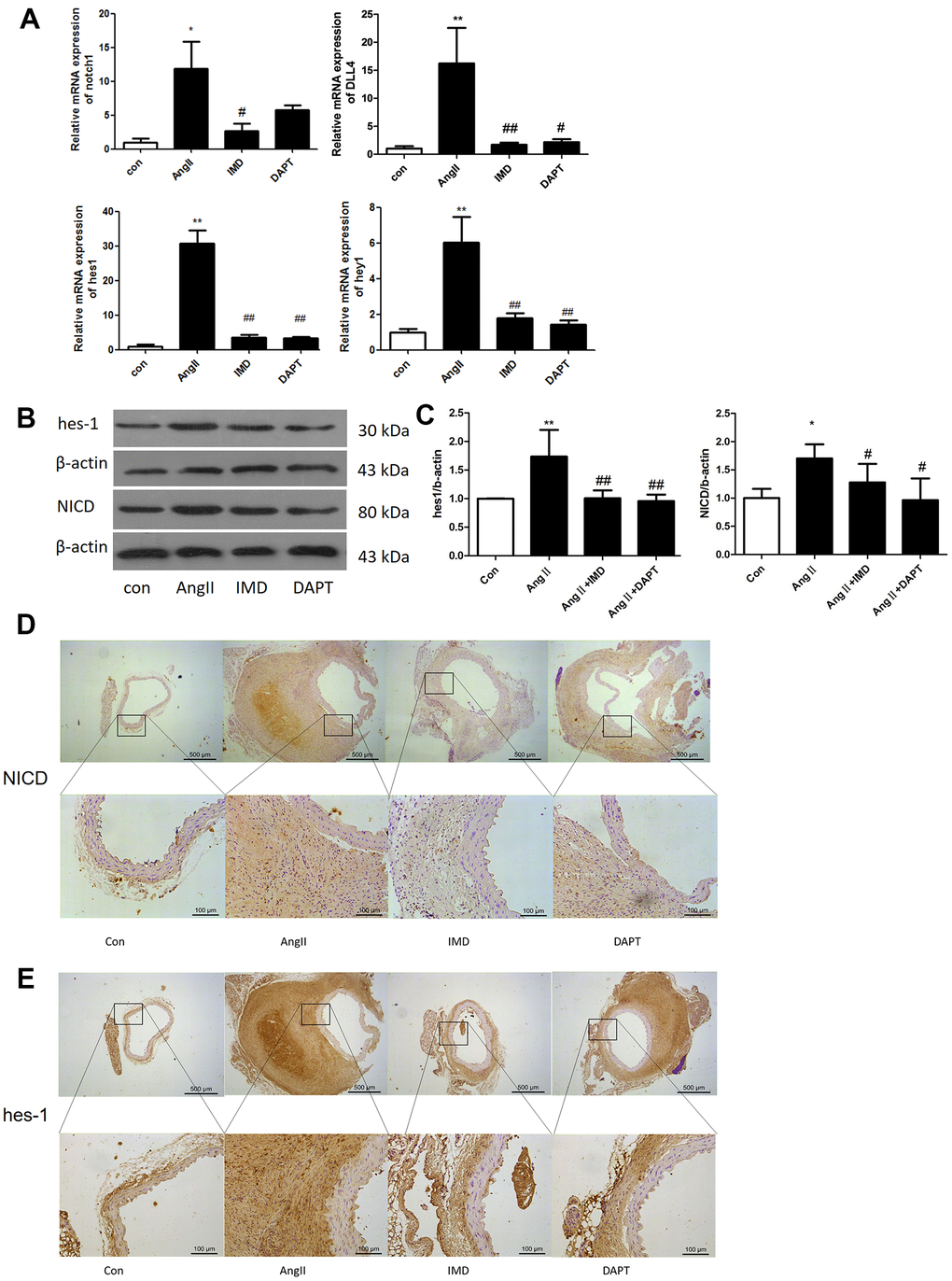 Notch1 signaling was activated in murine AAA. (A) Quantitative real-time PCR of Notch1, DLL4, hes1 and hey1 mRNA expression in aortas of mice with control (saline), AngII, AngII plus IMD and AngII plus DAPT. (B) Western blot analysis of hes1 and Notch1 signaling pathway marker NICD in aortas with Control, AngII, AngII+IMD and AngII+DAPT treatment. β-actin was a control for protein loading. Results are from 1 representative experiment of 3. (C) Quantification is shown as a ratio of β-actin expression. (D, E) Immunohistochemistry of the protein expression of NICD and hes1 in aortas of mice. Scale bar, 500 μm, 100 μm. Boxes and arrows show enlarged areas. Data are mean ± SD. *P0.05, **P#P##P