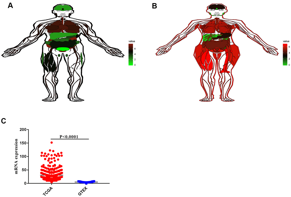 RNA expression of VCL in normal tissues and tumors. (A) VCL expression in different tissues of men. (B) VCL expression in different tissues of women.(C) Expression of VCL in tumor and normal tissues.