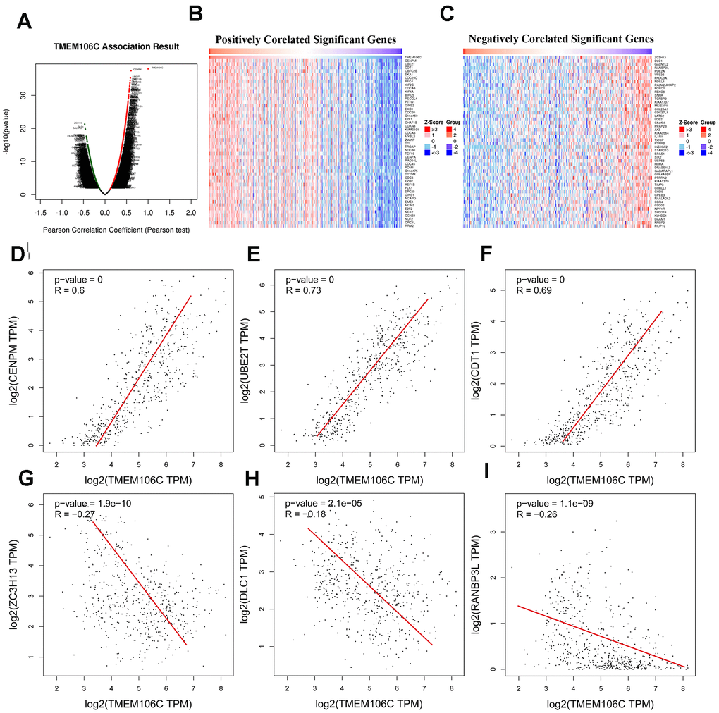 TMEM106C expression correlated genes in HCC (LinkedOmics and GEPIA). (A) Correlations between TMEM106C and differentially expressed genes in LIHC from LinkedOmics (Pearson test). Red indicates positively correlated genes, and green indicates negatively correlated genes. (B, C) Heat maps showing the top 50 genes positively and negatively correlated with TMEM106C in LIHC. (D–F) The scatter plots show the Pearson correlation of TMEM106C expression with the most positively correlated genes: CENPM, UBE2T and CDT1 (GEPIA). (G–I) The scatter plot shows the Pearson correlation of TMEM106C expression with the most 33 negatively correlated genes: ZC3H13, DLC1 and RANBP3L (GEPIA).