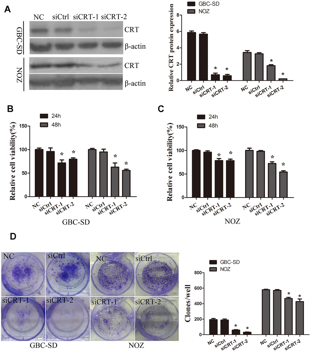 Knockdown of CRT significantly inhibits cell proliferation in vitro. (A) CRT expression following knockdown was confirmed by western blot assay. (B, C) CCK-8 assay was performed to analyze the proliferation of GBC-SD and NOZ cells. (D) Cell colony formation ability was detected by colony formation assay.*P