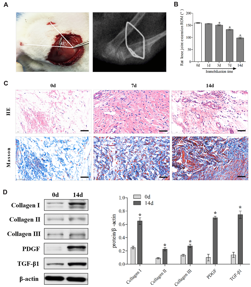 Establishment and identification of the rat knee joint PTJC model. (A) Schematic and X-ray of rat knee joint post-traumatic immobilization. (B) Measurement of extension ROM of the affected knee joint at Day 0, 1, 3, 7, and 14 post-modelling. (C) HE and Masson staining of the posterior joint capsule of the affected knee at day 0, 7, and 14 post-modelling. Scale bars, 50 μm. (D) Expression of fibrosis-associated protein (collagen I, collagen II, collagen III, PDGF, and TGF-β1) in the posterior joint capsule at day 0 and 14 post-modelling were assessed via western blot. Endogenous β-actin was used as an internal control. Error bars represent standard deviation. *P 