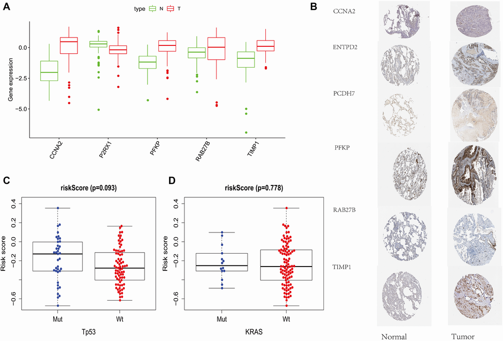 External data support. (A) Protein Expression of Risk Score Components in TCPA Database. (B) Immunohistochemical Results of Risk Score Components in HPA Database. (C) The relationship between PRS and TP53 mutations and KRAS mutations on GSE13213.