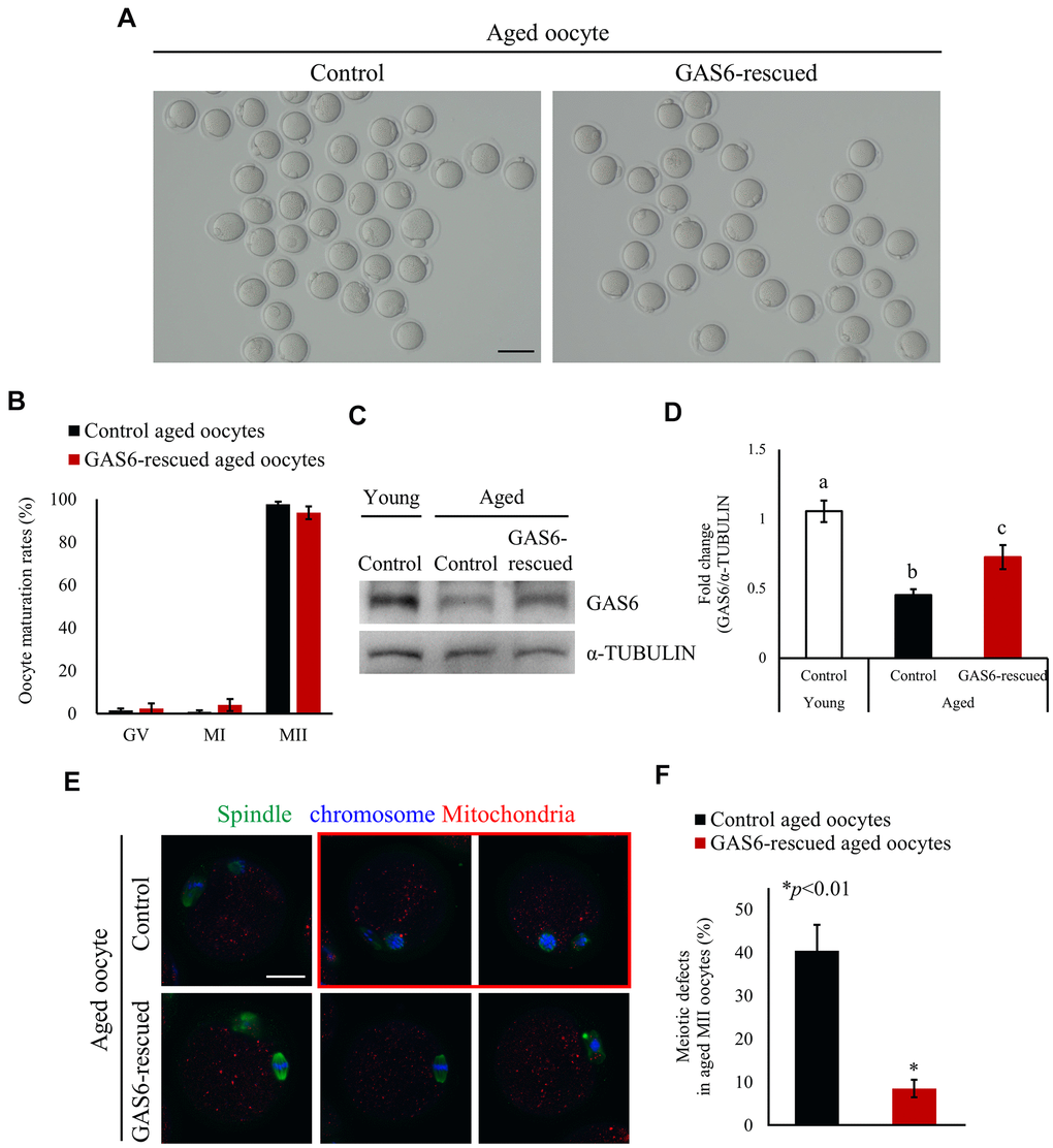 GAS6 ameliorates age-associated meiotic defects in oocytes. (A) Micrographs of aged MII oocytes treated without or with the GAS6 protein. Control, nontreated MII oocyte; GAS6-rescued, MII oocyte treated with the GAS6 protein. The scale bar represents 100 μm. (B) In vitro maturation rates of aged mouse oocytes after the microinjection of the GAS6 protein into GV-stage oocytes. After GAS6 restoration, these oocytes developed into morphologically normal MII oocytes, similar to the control groups. The data are presented as the means ± SEM. (C, D) Microinjection of the GAS6 protein led to a partial recovery of the decreased GAS6 levels induced by maternal aging. α-TUBULIN was used as a loading control. Relative expression levels of the GAS6 protein are presented in a bar graph and compared to the control young oocyte group. The data are presented as the means ± SEM. Different letters indicate significant differences at pE) Immunofluorescence staining for spindles and chromosomes in aged MII oocytes after injection of the GV oocytes without (control) or with the GAS6 protein (GAS6-rescued), which were then allowed to mature in vitro. Green, spindle; blue, chromosome; red, mitochondria; red box, oocyte with abnormal spindle and chromosome alignment. The scale bars represent 25 μm. (F) Proportions of control or GAS6 protein-injected MII oocytes with defects in spindle assembly and chromosome configuration.