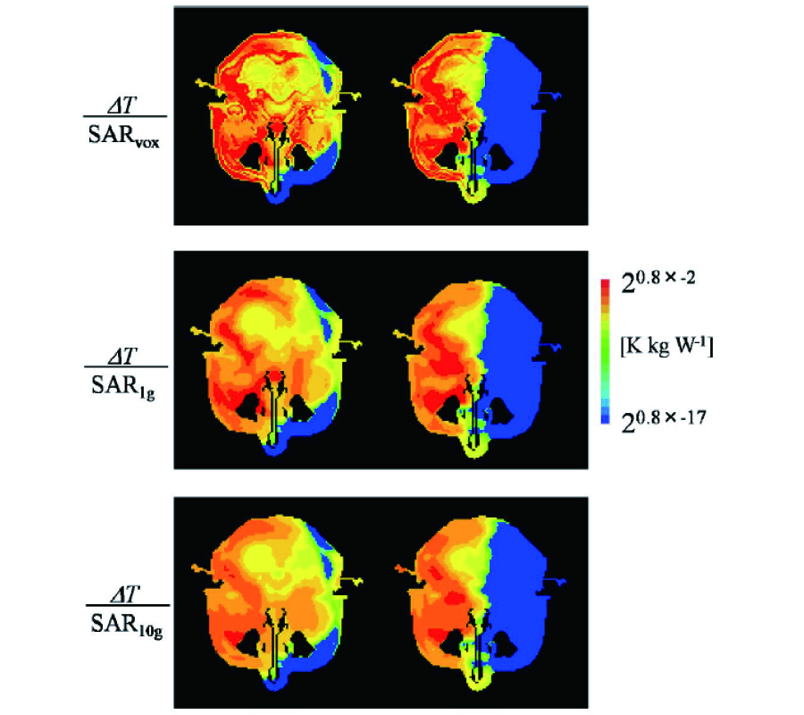 ON AVERAGING MASS OF SAR CORRELATING WITH TEMPERATURE ELEVATION DUE TO A DIPOLE ANTENNA