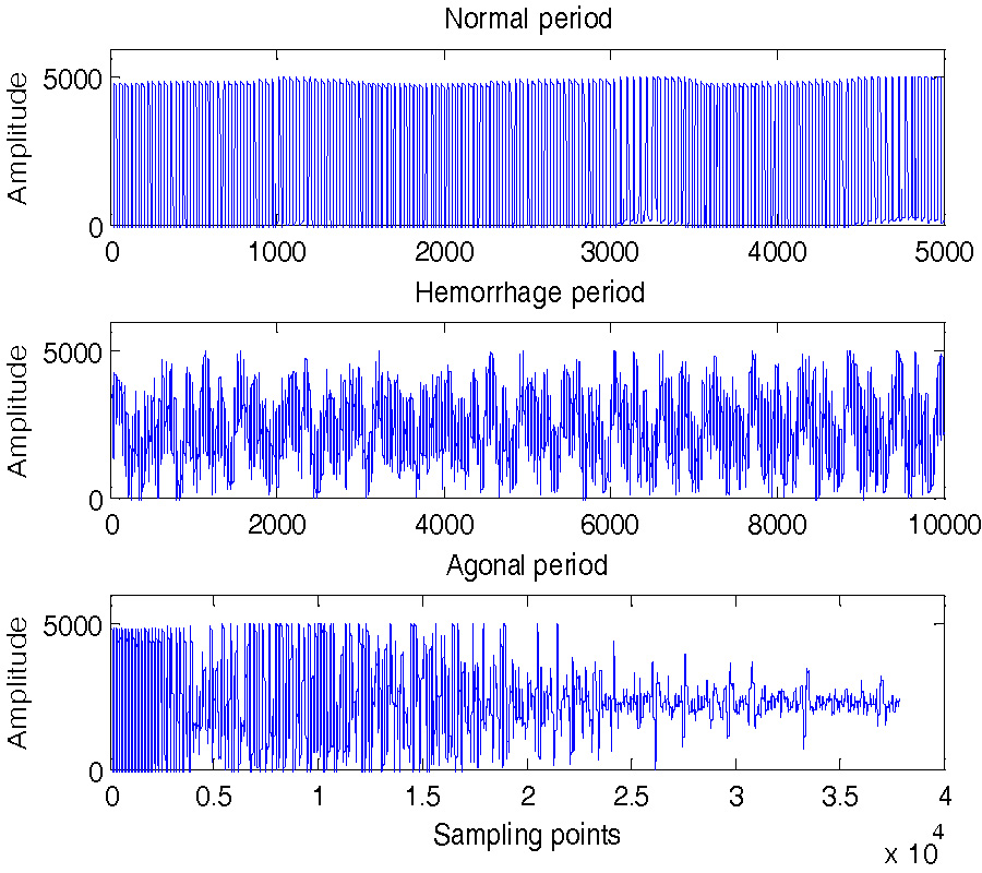 NON-CONTACT DETERMINATION OF VITAL SIGNS MONITORING OF ANIMALS IN HEMORRHAGE STATES USING BIO-RADAR