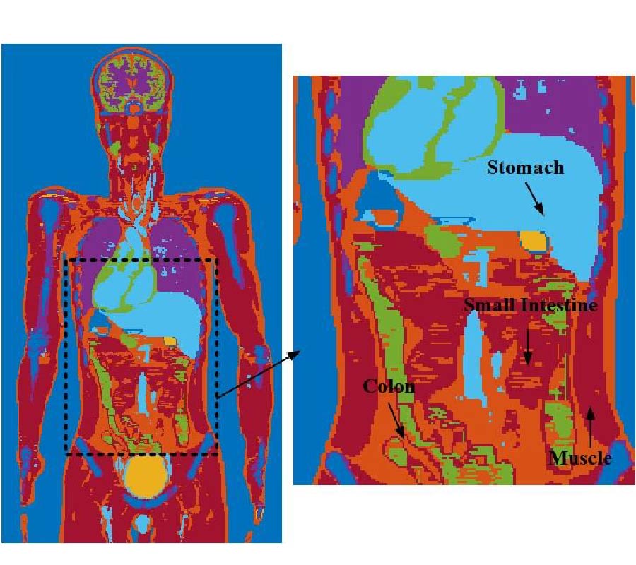 A MULTI-BAND CYLINDRICAL CONFORMAL ANTENNA WITH LOW SPECIFIC ABSORPTION RATE FOR WIRELESS MEDICAL CAPSULE ENDOSCOPY