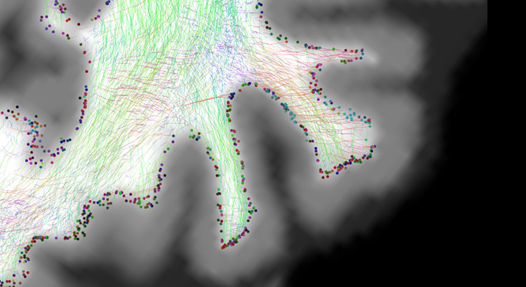 Anatomically Constrained Tractography (ACT)