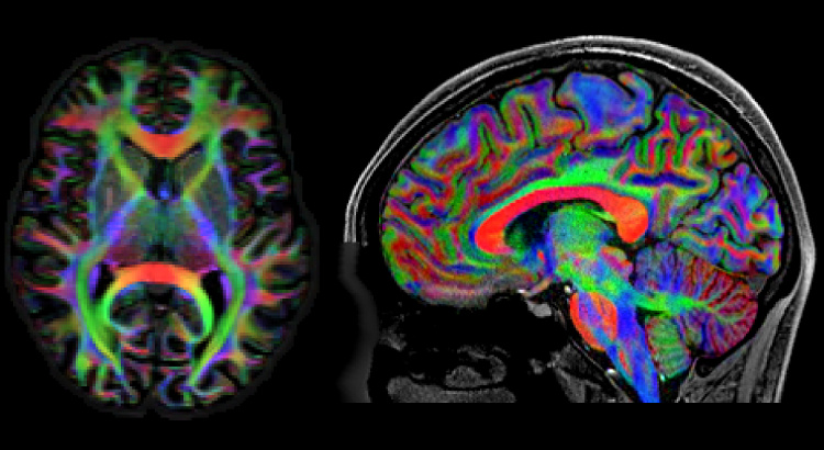 FOD-based DEC maps and panchromatic sharpening