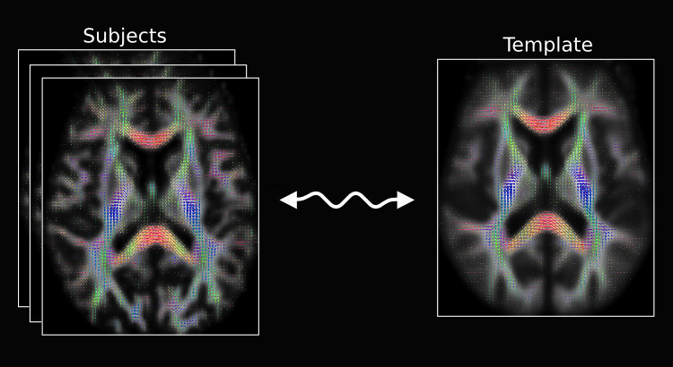 Image registration for diffusion MRI