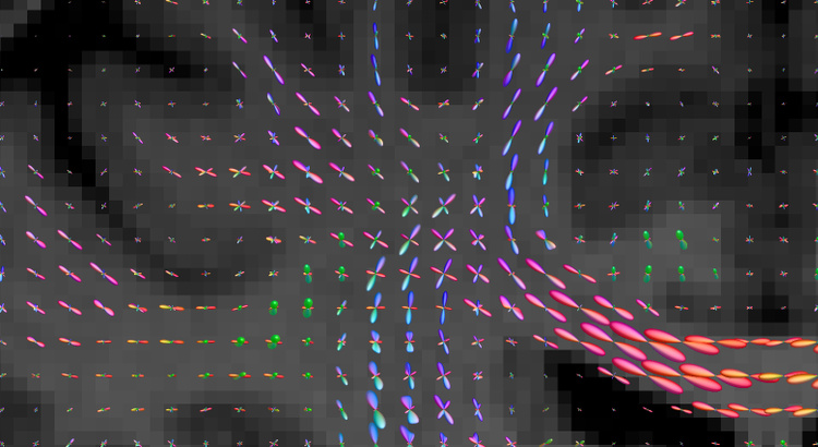 Constrained spherical deconvolution (CSD)