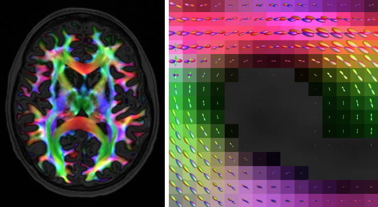 Track Weighted Imaging framework