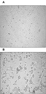 Thumbnail of Cytopathic effect (CPE) of primary severe acute respiratory syndrome–associated coronavirus strain HSR1 isolate. A, uninfected Vero cells form a continuous monolayer of spindle-shaped cells. B, a strong CPE was observed after 24 hours of incubation of Vero cells with the patient sputum sample (primary isolate).