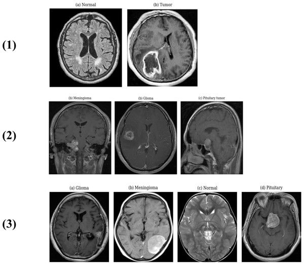 Some MRI samples images from different datasets: (1) (a) Normal image from Brats-large-2C dataset, (1) (b) Tumor image from Brats-large-2C dataset, (2) (a) Meningioma image from Cheng dataset, (2) (b) Glioma image from Cheng dataset, (2) (c) Pituitary tumor image from Cheng dataset, (3) (a) Glioma image from Brats- large-4C dataset, (3) (b) Meningioma image from Brats-large-4C dataset, (3) (c) Normal image from Brats-large-4C dataset, (3) (d) Pituitary tumor image from Brats-large-4C dataset.