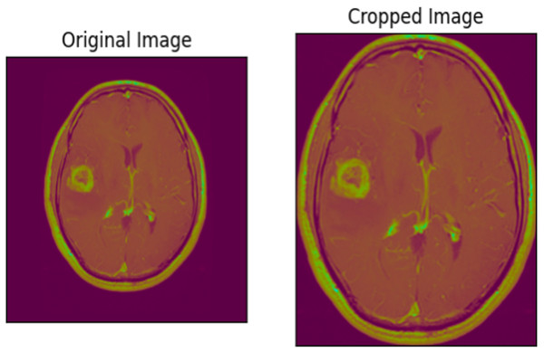 An MRI image before and after cropping.