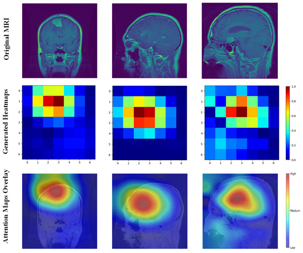 Grad-CAM visualizations of the regions of interest.