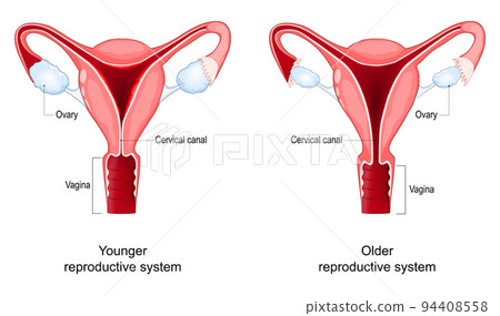 Menopause. Climacteric changes in the vagina, ovary and cervix. 94408558