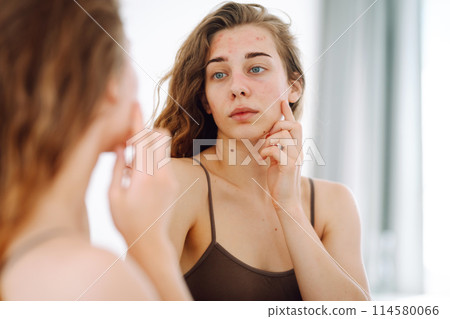 Portrait of a young woman touching pimple on her face while looking in mirror. Facial skin problems. 114580066