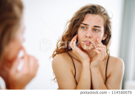 Portrait of a young woman touching pimple on her face while looking in mirror. Facial skin problems. 114580070