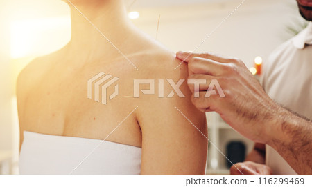 Acupuncture, hands and shoulder in spa with customer treatment for healing, stress relief or therapy. Body, holistic and relax with masseuse in resort or resort for cosmetics, massage and skincare 116299469