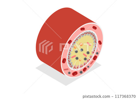 3D Isometric Flat  Illustration of Celiac Disease, Gluten Intolerance 117368370