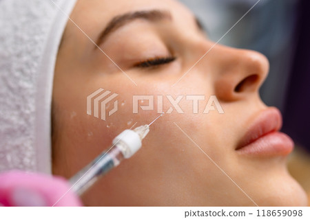 Beautiful relaxed woman at beautician cabinet receiving anti wrinkle injections on cheekbones, lying with closed eyes in beauty salon 118659098