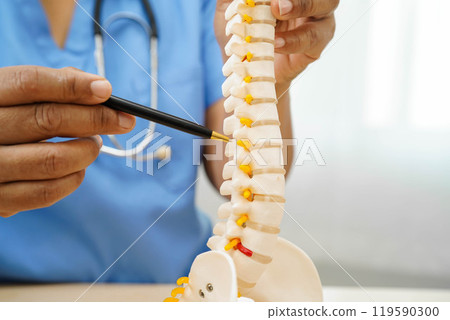 Asian doctor holding spinal nerve and bone model, Lumbar spine displaced herniated disc fragment for treatment medical in the orthopedic department. 119590300