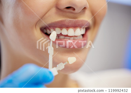 Dentist, cleaning and dental procedure for toothache in clinic, health and treatment for mouth. Teeth whitening, face and person with torque wrench machine, orthodontics and oral care for veneers 119992432