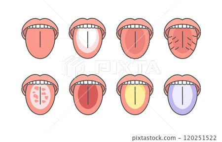 舌頭健康狀態類型插圖集 120251522