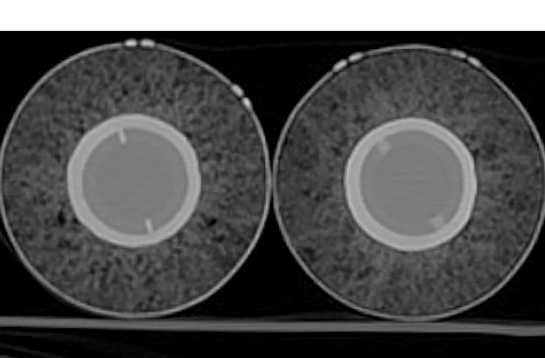 Closer look at 2014 -- 2015 baseball CT scans