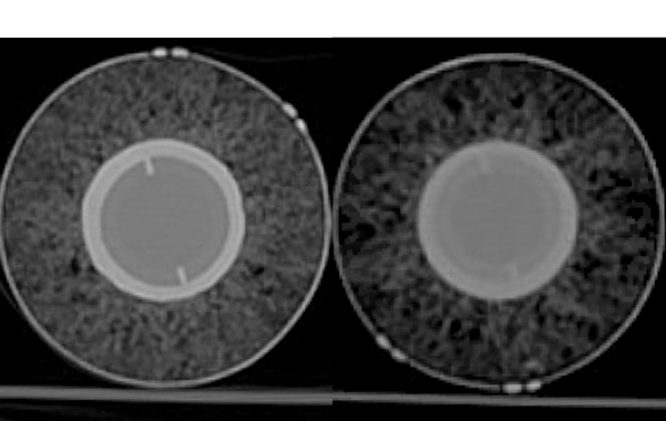 Comparison of CT scans from a 2014 -- 2015 baseball to its 2016 -- 2017 counterpart