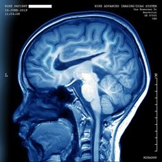 an mri image shows the location of the brain and its surrounding areas, including the top part of the head