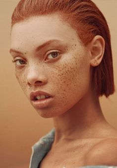 a woman with freckles on her face looking at the camera