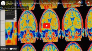 Screen shots of brain scans