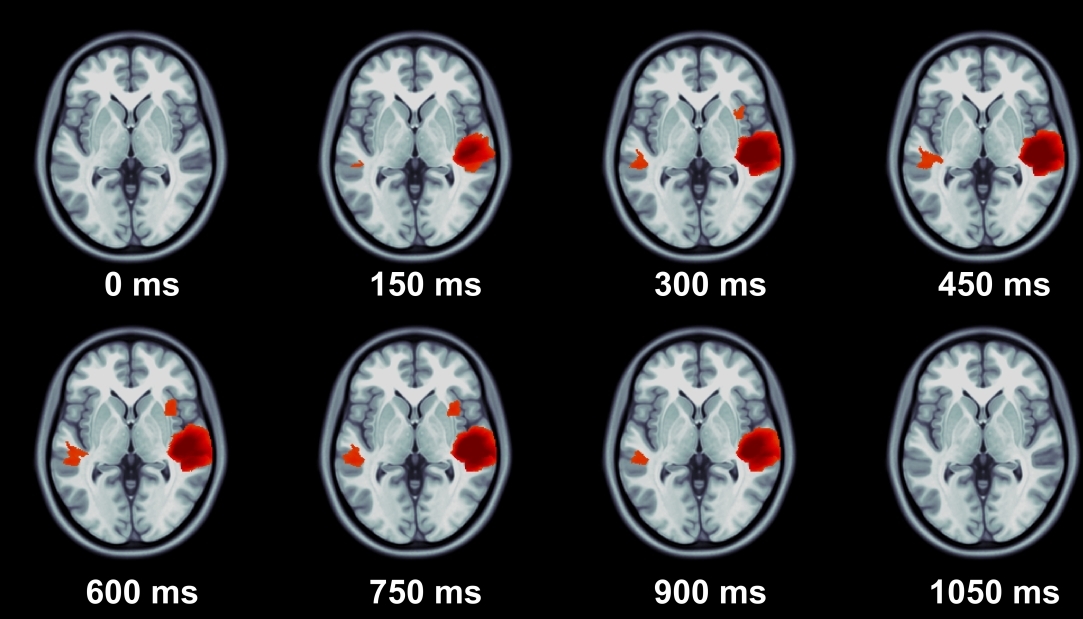 The new paper of the Center for Language and Brain in Human Brain Mapping